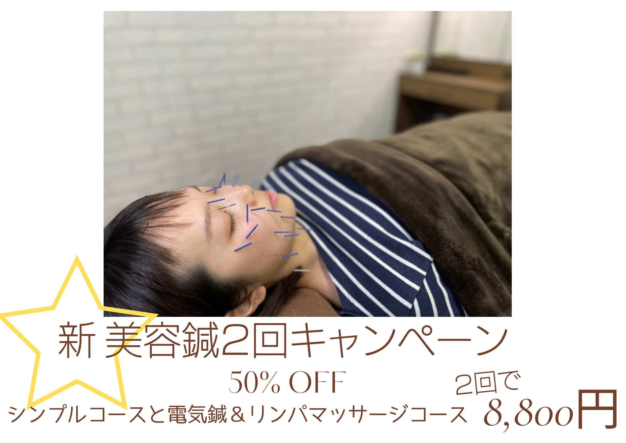 新美容鍼
