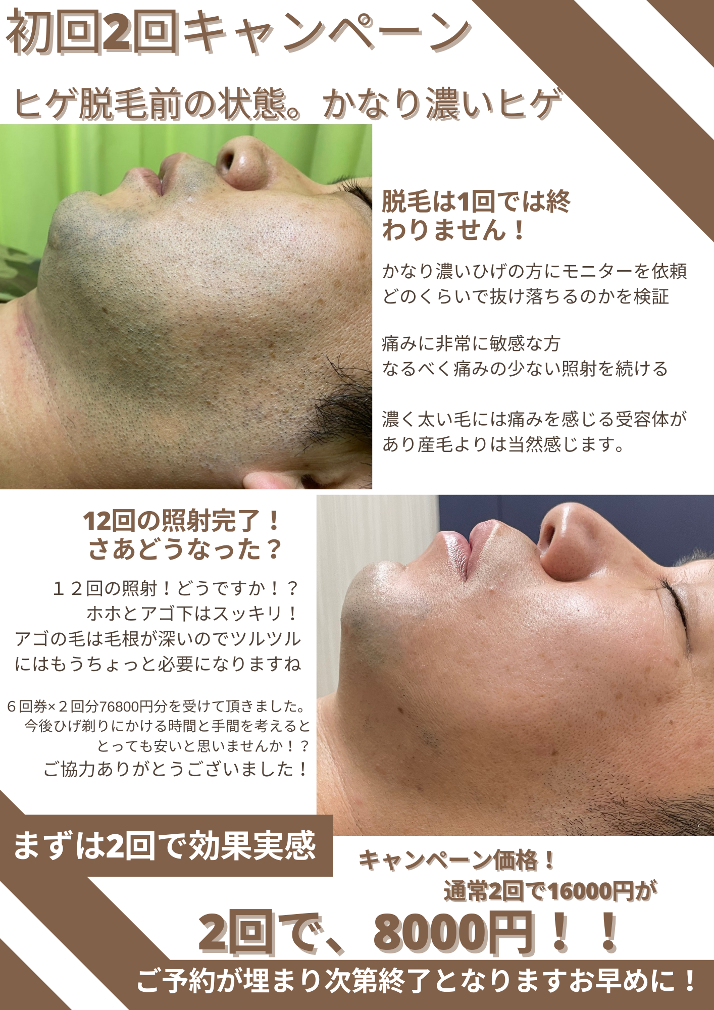 ヒゲキャンペーン