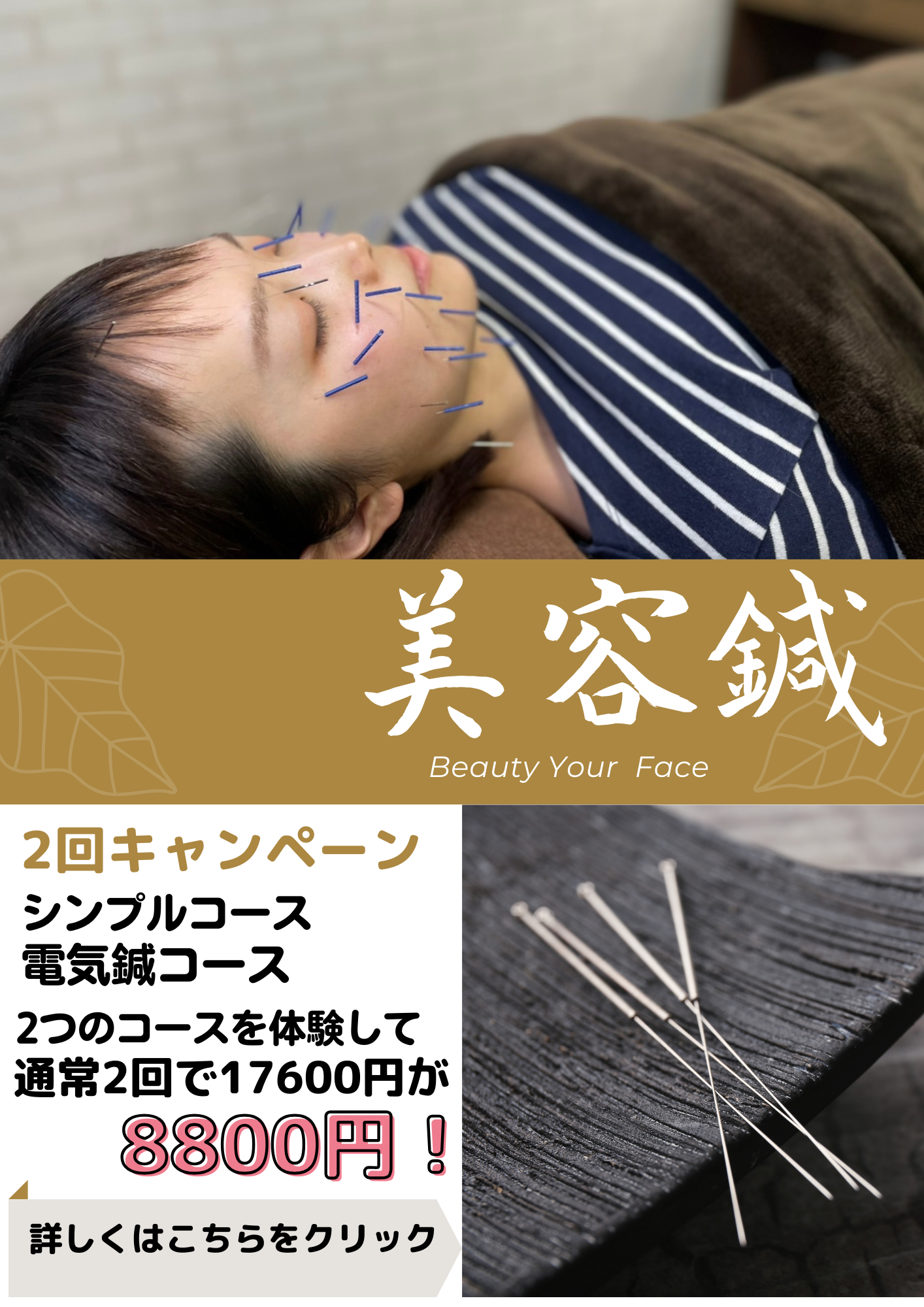 美容鍼