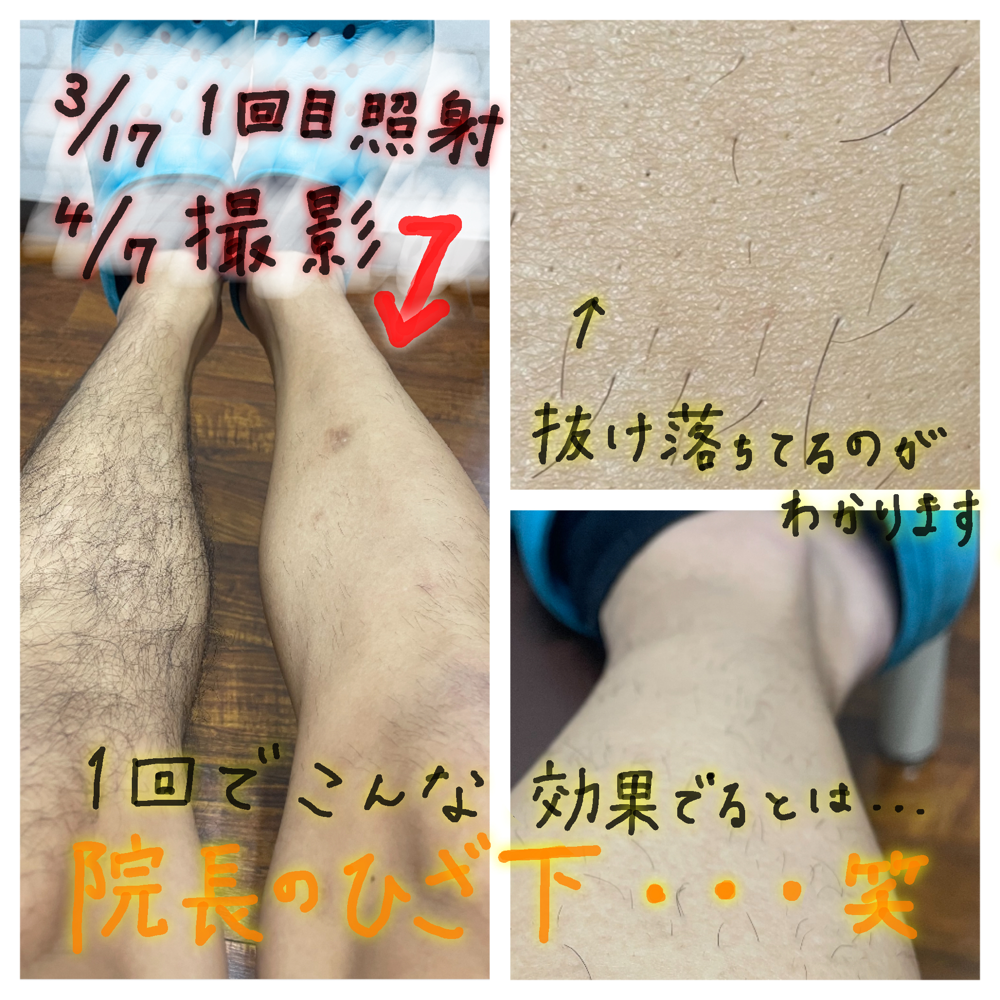 どっちがお好き